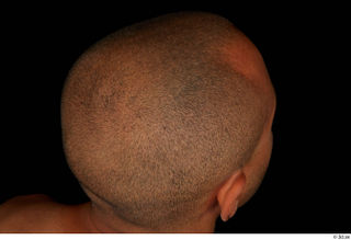 Aaron bald hair 0006.jpg